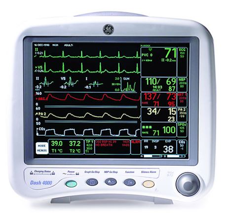 You are currently viewing An Overview of Patient Monitoring Devices
