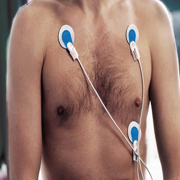 Ambu Bluesensor R ECG Electrodes – Adult