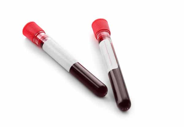Read more about the article 2 Important Reasons to Collect Blood Sample Prehospital