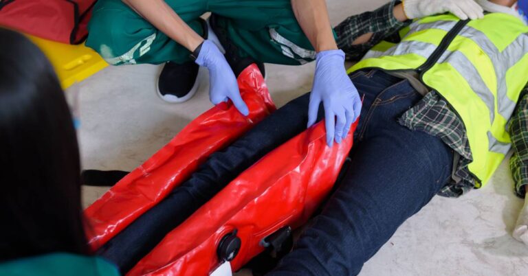 Read more about the article Innovative Splinting Techniques and Devices for First Responders